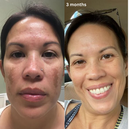 Adaptory™ Dark Spot Serum