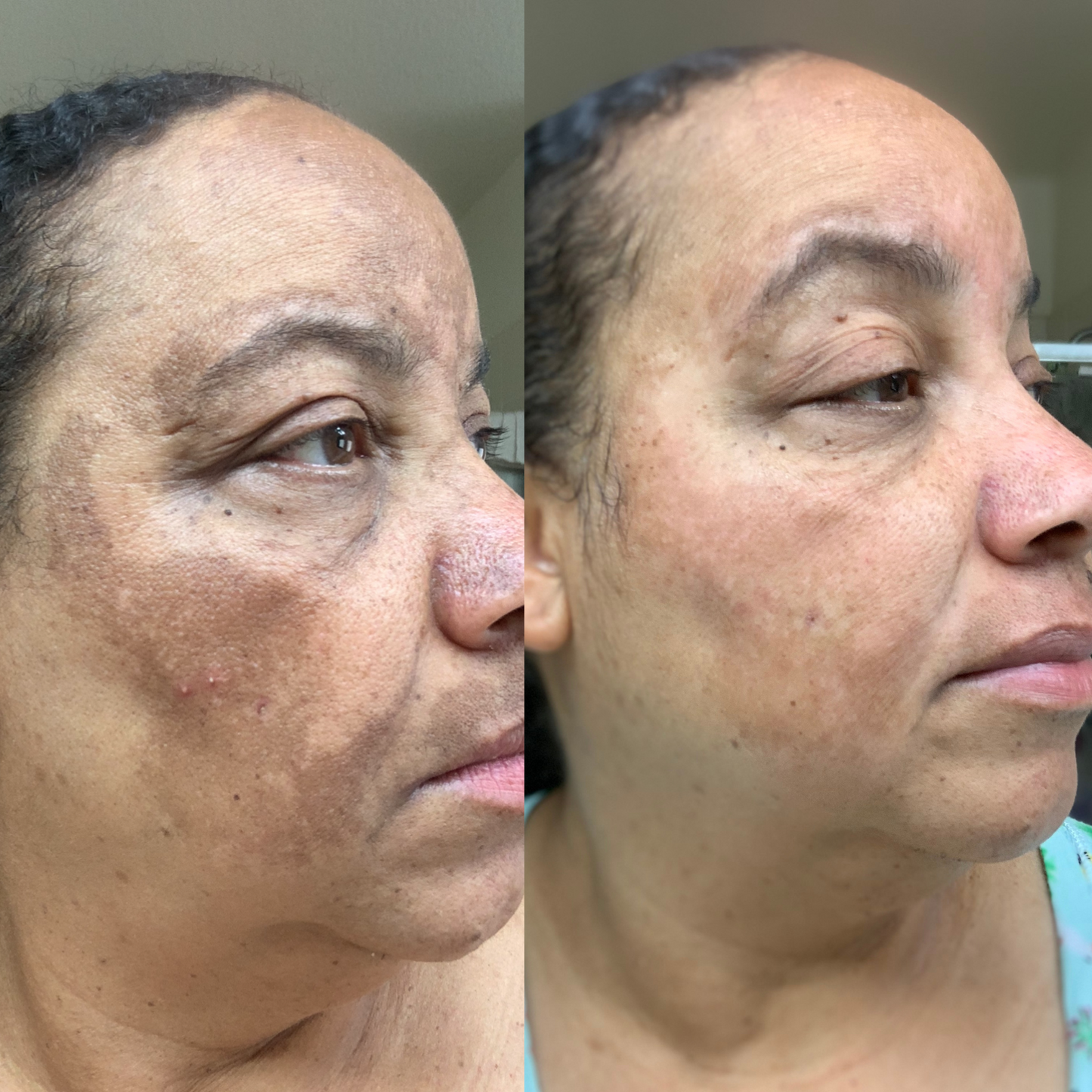 Adaptory™ Dark Spot Serum