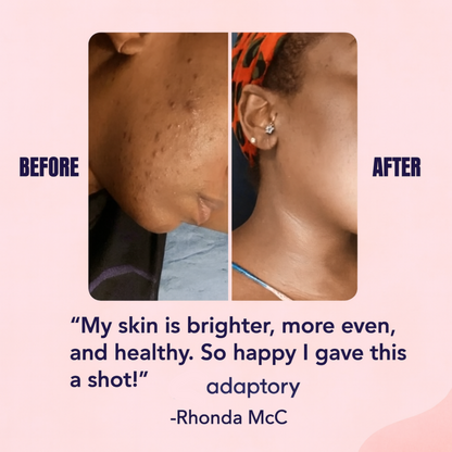 Bright Skin Without the Burn. Guranteed.
